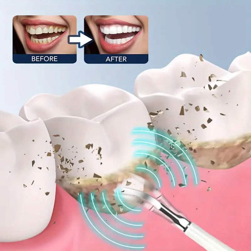 ProClean Electric Teeth Whitening Tool Set